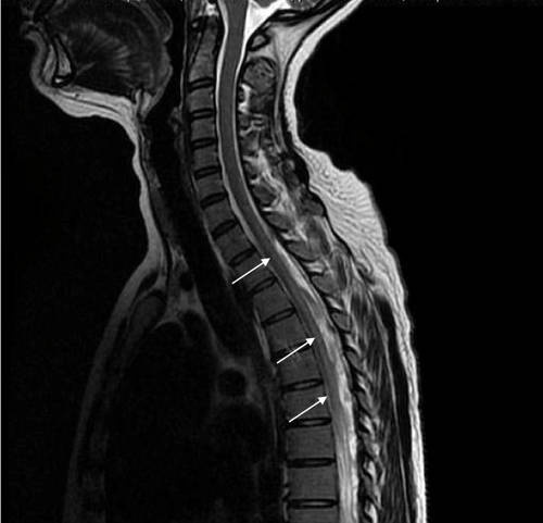 what does mri show in neck and spine?