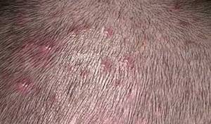 Bumps on Scalp, Itchy, Lumps, Large, Small, Cyst, Painful ...