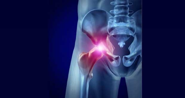 hip flexor strain and abdominal pain
