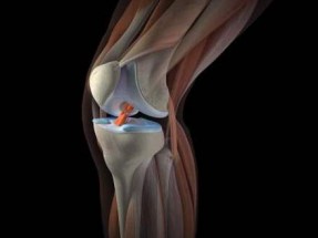 knee hurts when bent backwards