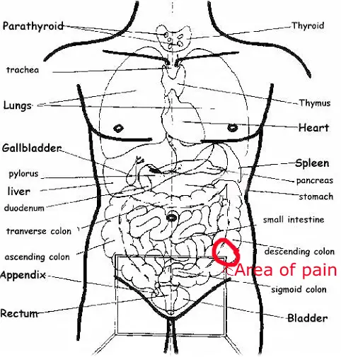 Sharp Pain in Lower Left Abdomen in Males and Females | IYTmed.com