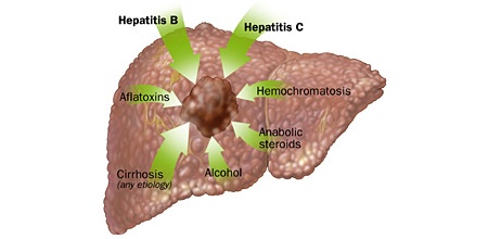 pain liver area symptoms