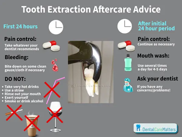 Wisdom Tooth Extraction Pain Scale