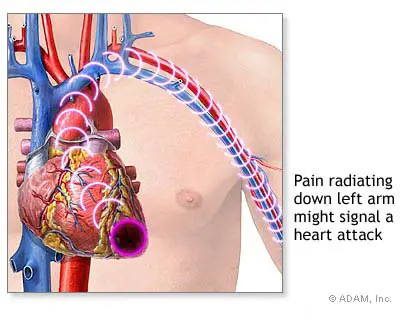 sharp chest pain on the left side