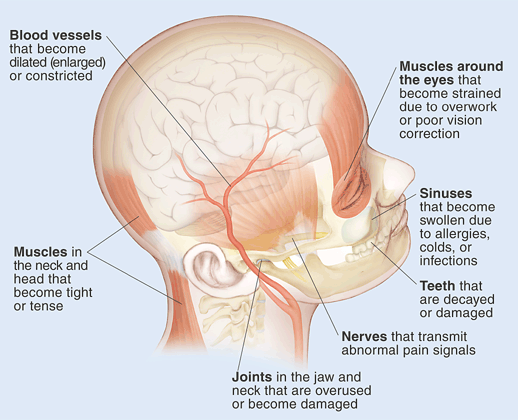 headache behind eyes base skull