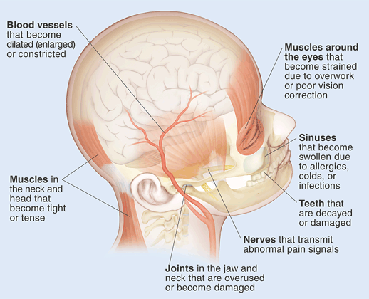 Headache Behind Eyes Base Skull Health Recovery Tips