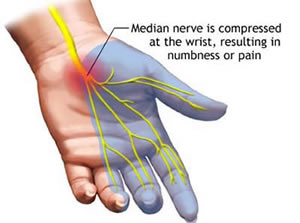 continuous pins and needles in hands and feet