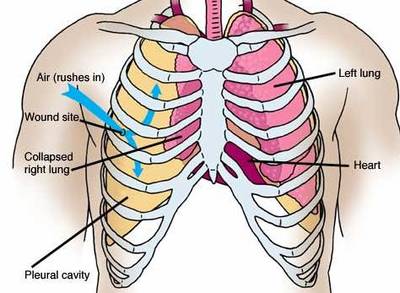 pain in right side of chest and back and neck