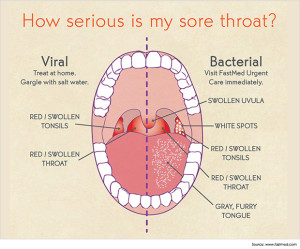 how to get rid of throat pain due to cold