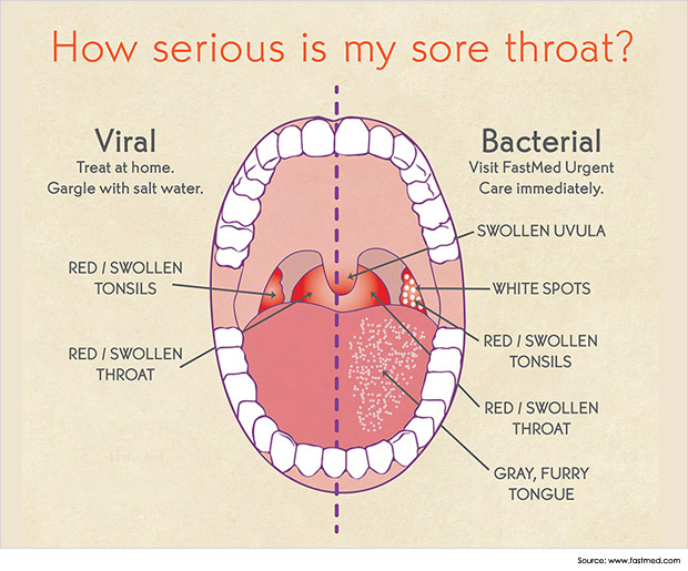 home remedies for throat infection and body pain