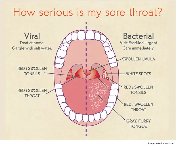 coughing when throat deep Pain in