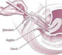 Sharp Pain in Cervix