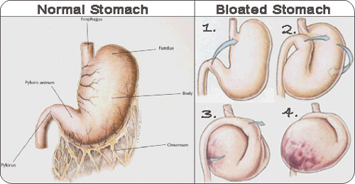 Normal Stomach vs Bloated Stomach