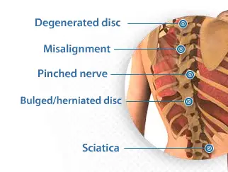 severe lower back pain comes and goes