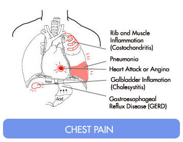 pain in centre of chest