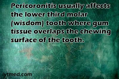 swollen gums around wisdom tooth remedies