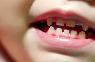 teeth