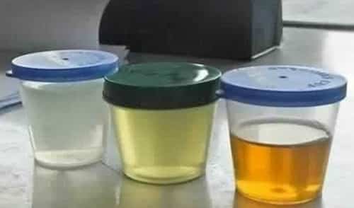 Urine is medically defined as a liquid by-product of the body secreted by the kidneys through a process called urination (or micturition) and excreted through the urethra.