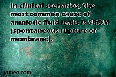 signs of leaking amniotic fluid vs discharge