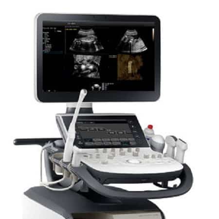Ultrasound to detect miomas
