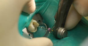 sharp pain after root canal treatment