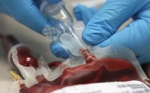 septic shock definition causes symptoms and treatment
