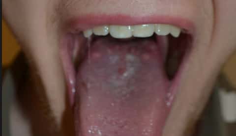 92 Large Bumps Back Tongue Girl 