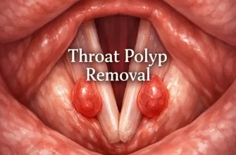 Anatomical illustration of the vocal cords showing benign throat polyps on both vocal folds