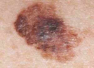 | Health Recovery Tips
