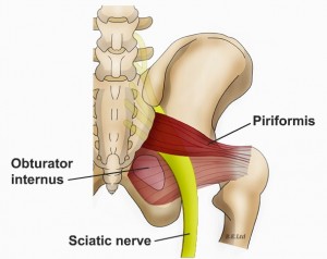 sciatic nerve pain during pregnancy symptoms