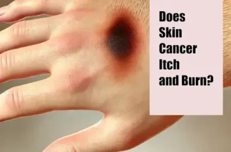 Does Skin Cancer Itch and Burn?