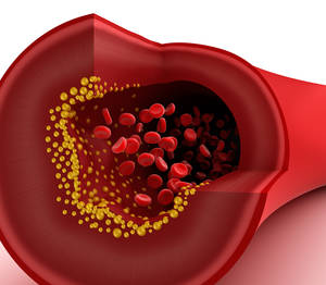 what is good cholesterol ratio