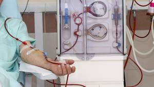 kidney dialysis process