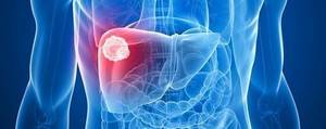 liver hemangioma growing