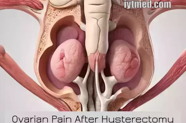 Ovarian Pain After Hysterectomy