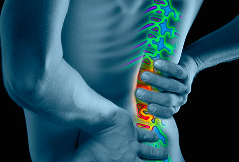 at home remedies for back spasms