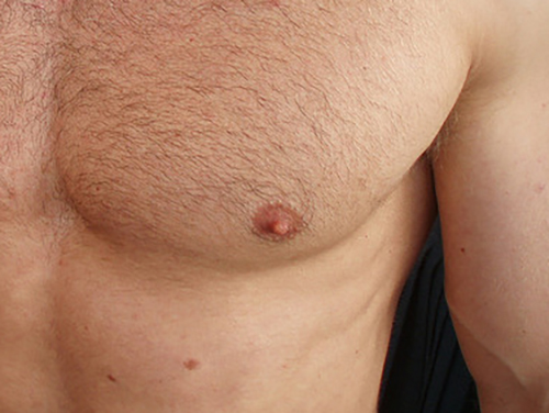 Male Hard Nipples 57