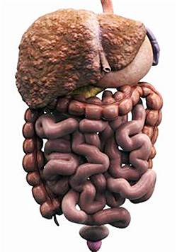 cirrhosis liver end stage symptoms