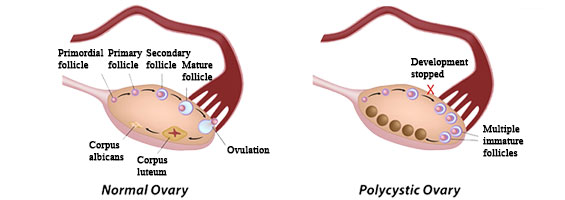 lower left abdominal pain near ovary