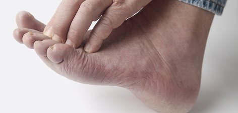 What causes itching hands?