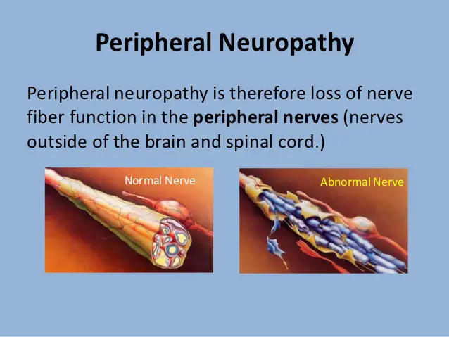 peripheral neuropathy