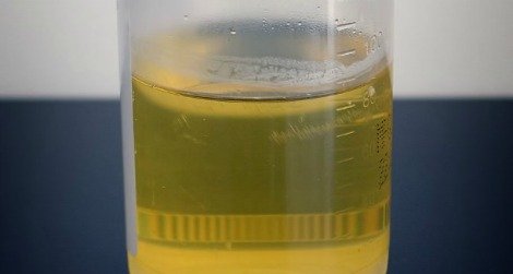 urine smells weird and strong