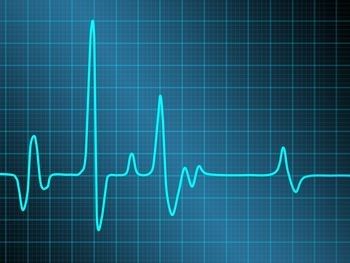 increased heart rate after moderna booster