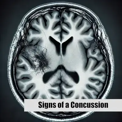 Signs of a Concussion