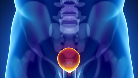 bladder pain close to the end of urination