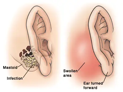 Is ear pain a cancer symptom?