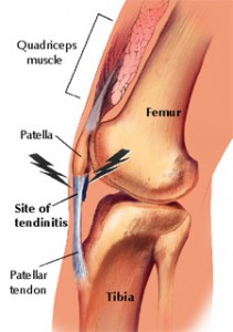 sharp pain in knee