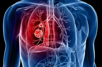 A 3D medical visualization of the human chest cavity showing a malignant tumor mass in the right lung with highlighted respiratory pathways in red.