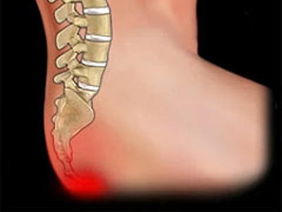 pain near anus bone