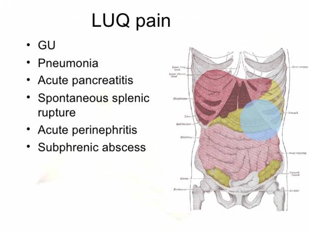 Upper Left Abdominal Pain